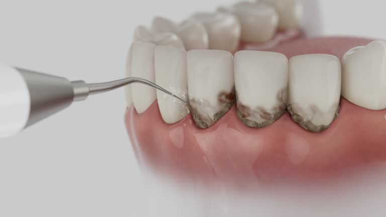 Reliable Root Canal Treatment contractor in Ransom County County, ND by Dentist Open Now